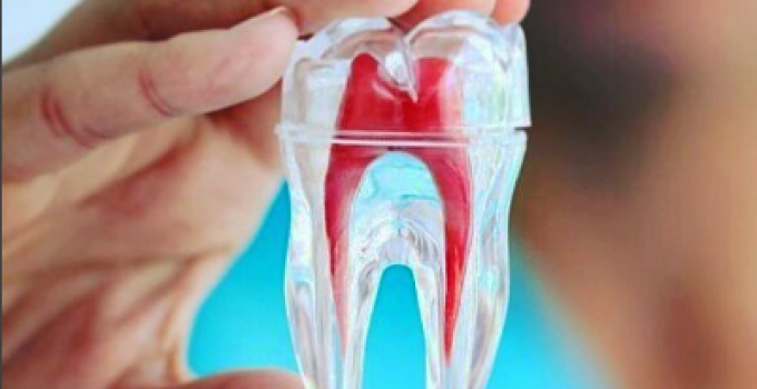 ¿Porqué Duelen Los Dientes Al Masticar?