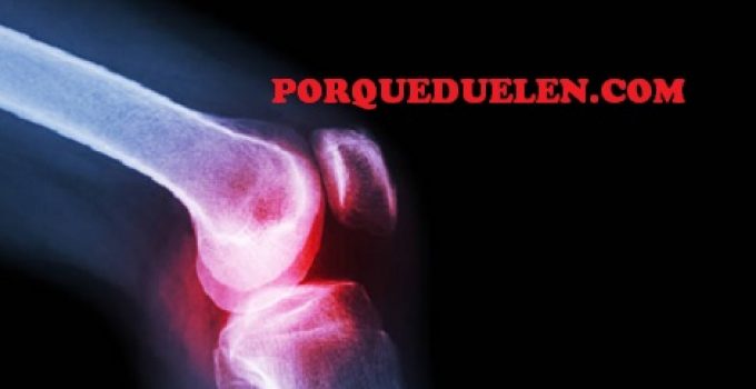 porque duelen las rodillas y truenan al doblarlas